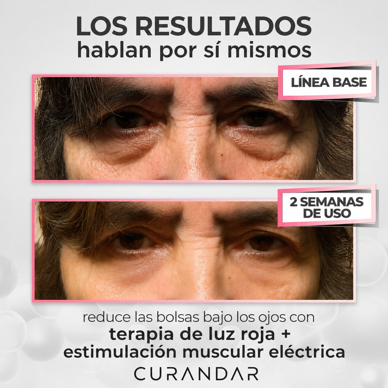 Curandar® 2-in-1 Red Light Therapy + EMS To Erase Eye Bags