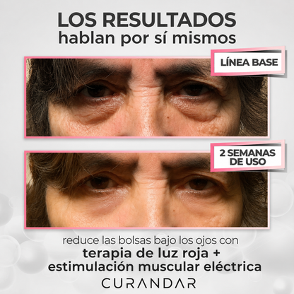 Curandar® 2-in-1 Red Light Therapy + EMS To Erase Eye Bags