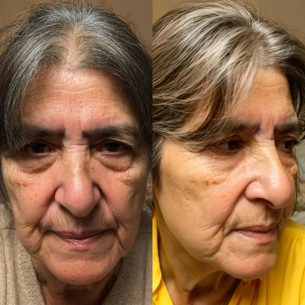 Mildred R. - antes y despues