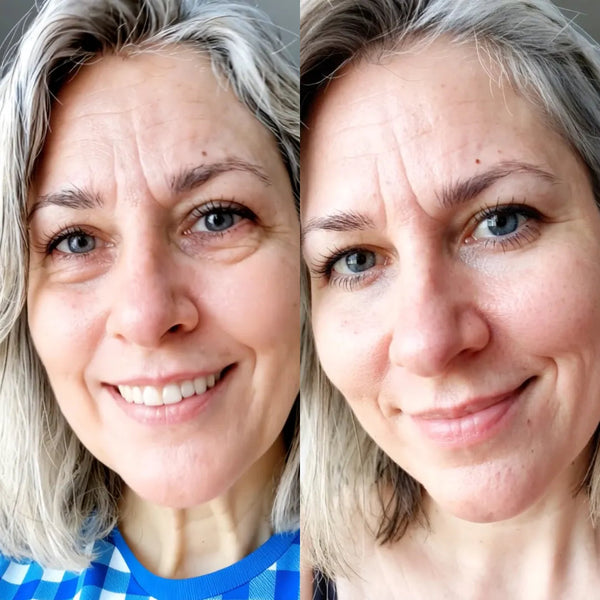 Arlene W. - antes y despues