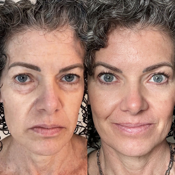 Gabrielle P. - antes y despues