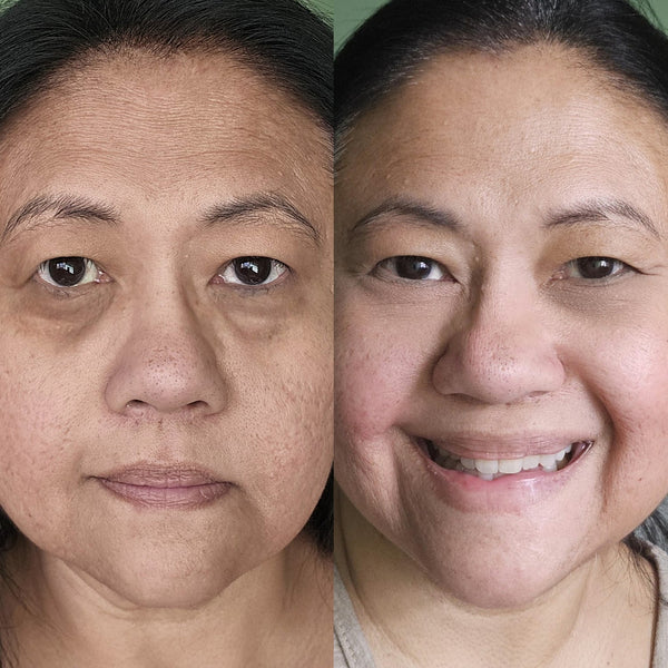 Yasmine T. - antes y despues