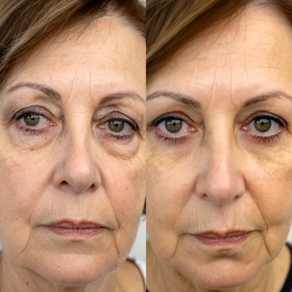 Curandar® 2-in-1 Red Light Therapy + EMS To Erase Eye Bags