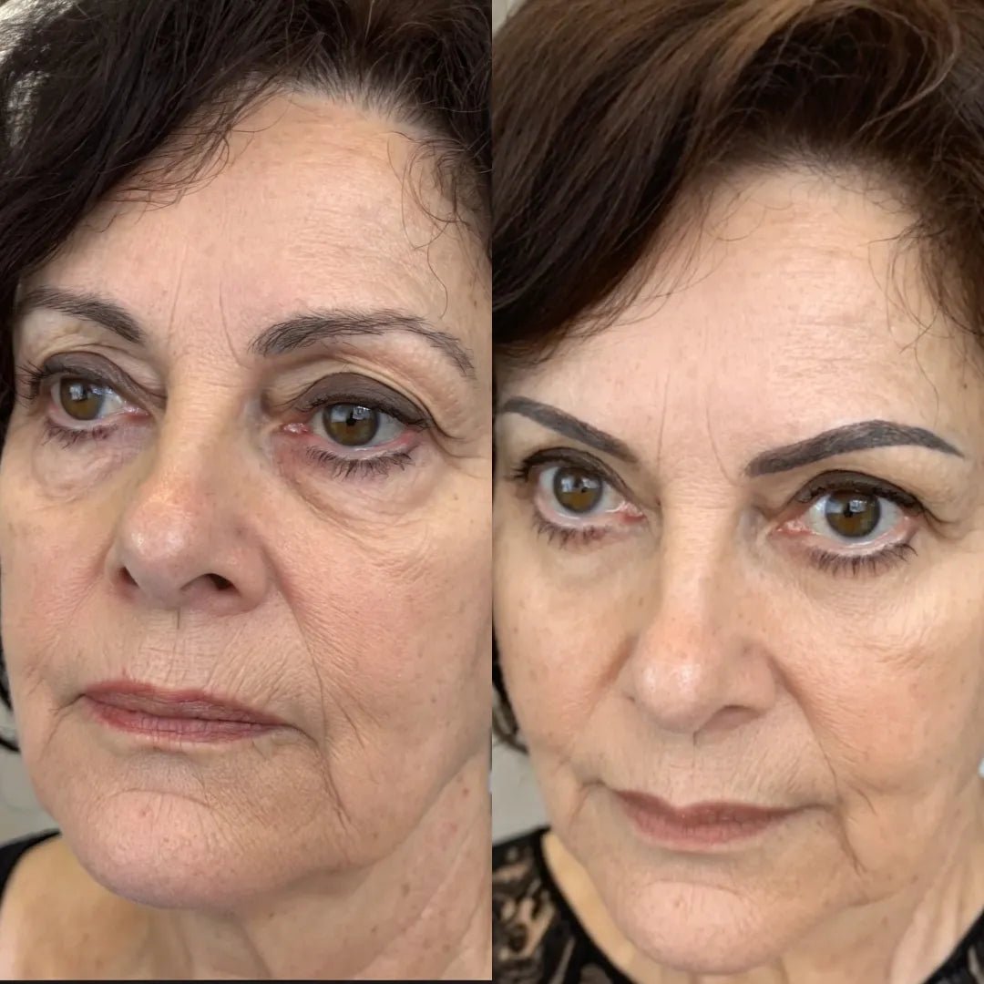 Curandar® 2-in-1 Red Light Therapy + EMS To Erase Eye Bags