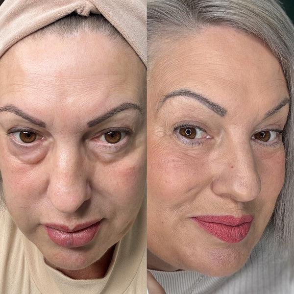 Lily R. - antes y despues